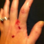 Former Diva Attacked by Cat, Receives Medical Attention