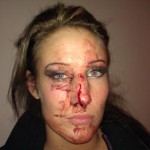 AIW Girls Night Out 5 Results: Del Rey vs Knuckles, Allysin Kay Suffers Broken Nose & More
